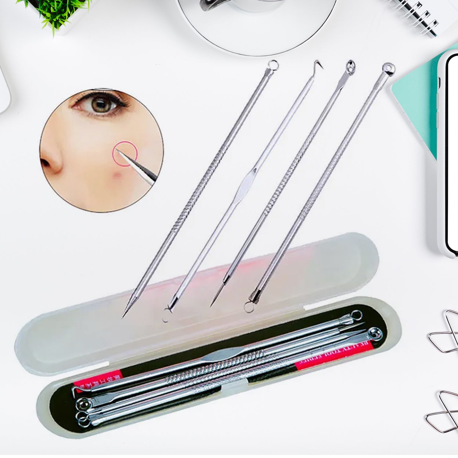 Blackhead Remover Tool – 4-in-1 Stainless Steel Extractor | ToolMate Pro Secondary image