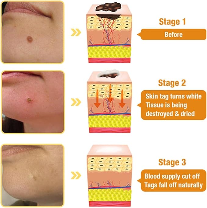 Bee Venom Skin Treatment Cream,Repair Maximum Strength for All Skin Types (2PCS) Secondary image