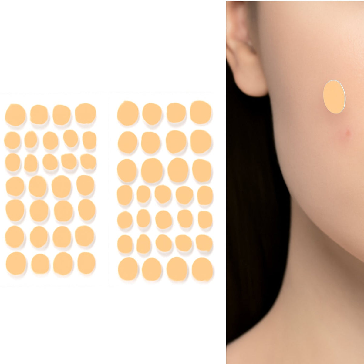 GlowForm hydrocolloid pimple patches sheet with tea tree oil for acne treatment. Main image