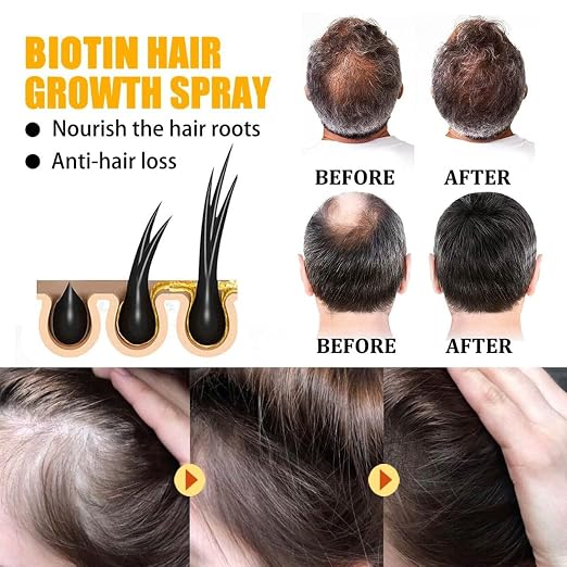Premium Hair Growth Serum (Pack of 2) Secondary image