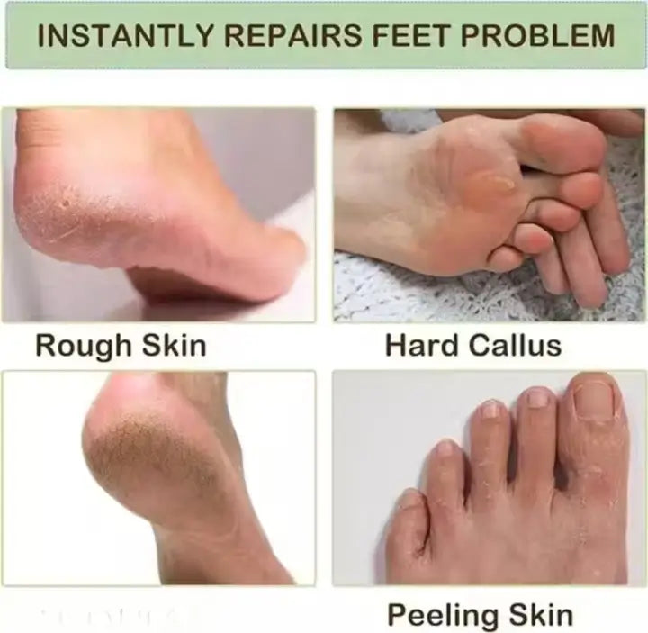 Moisturizing Silicone Gel Socks – Foot Care Spa Socks
