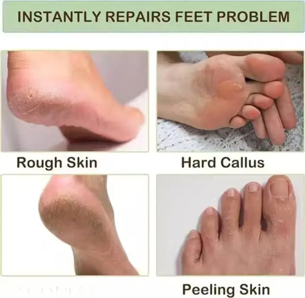 Moisturizing Silicone Gel Socks – Foot Care Spa Socks