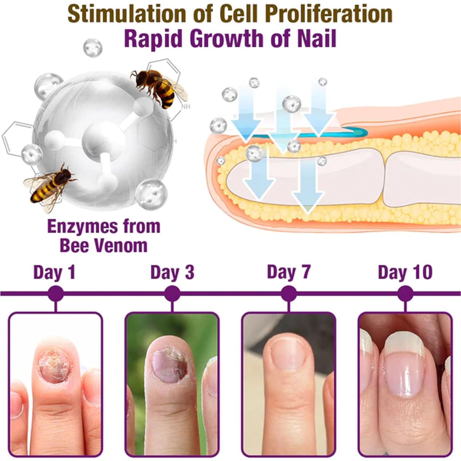 Bee Venom Nail Treatment Serum, Natural Ingrown Toenail and Nail Growth Repair ( Pack Of 2 ) Secondary image