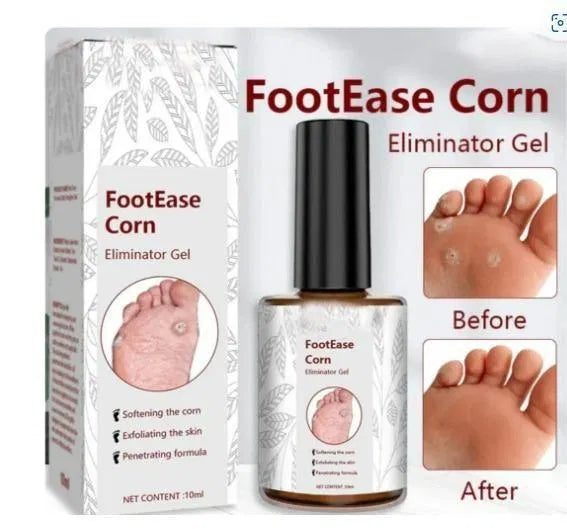 Feet Corn Removal Serum 30ml ( Pack Of 1 ) Main image