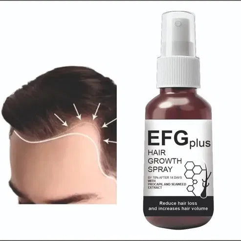 Hair Growth Spray – 50ml (Pack of 2) Secondary image