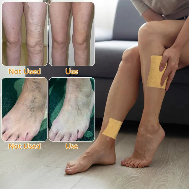 Turmeric Varicose Veins Treatment for Legs Patch, Naturally Relieves Varicose Veins in Legs and Spiders Secondary image