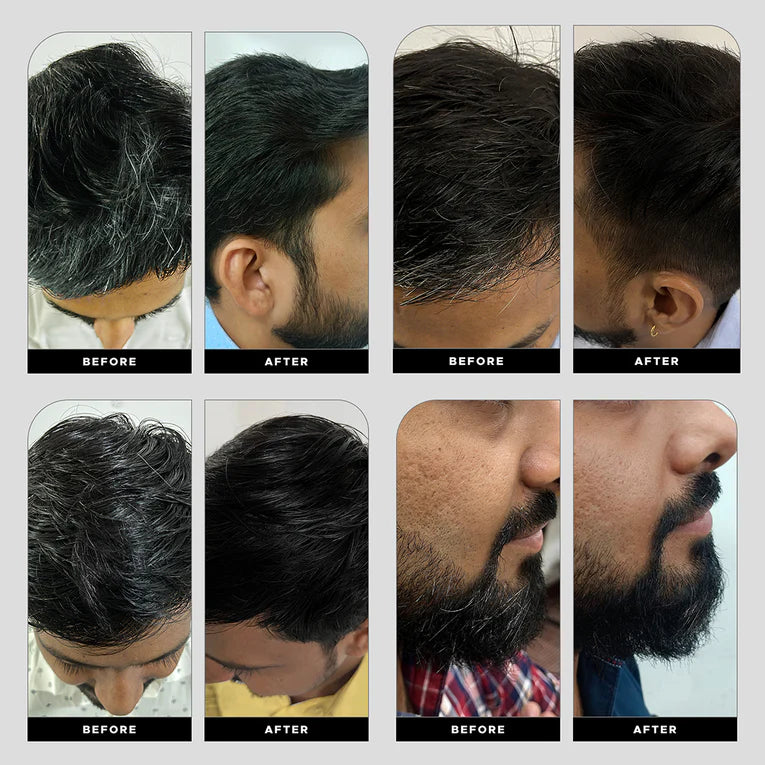 PLANT EXTRACT HAIR SHAMPOO FOR GRAY HAIR Secondary image