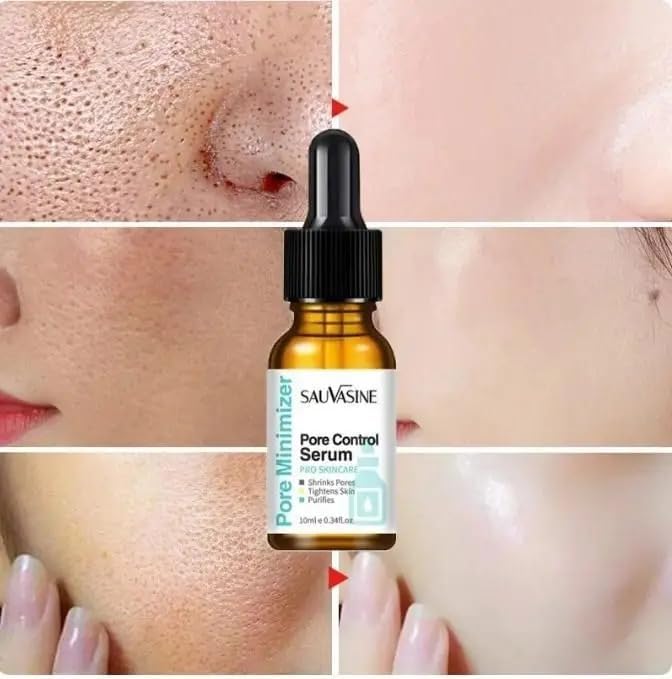 Face Serum Remover Blackheads Dark Spots Acne Treatment Oil Control Moisturizing Secondary image