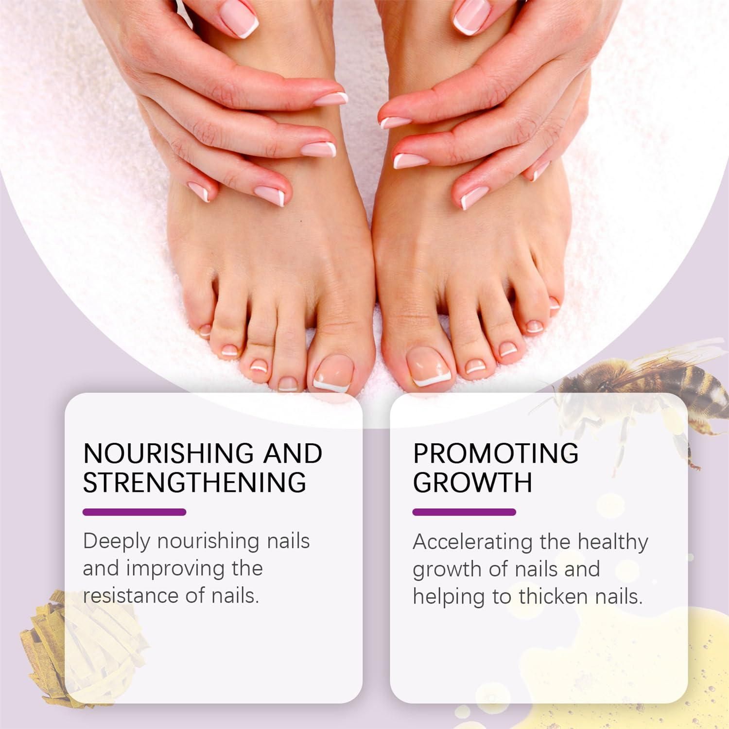 Fungi Free Bee Venom Nail Treatment Solution Serum (15ml) Secondary image
