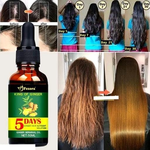 Ginger hair oil (PACK OF 1) Secondary image